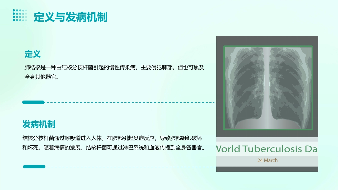 肺结核PPT课件