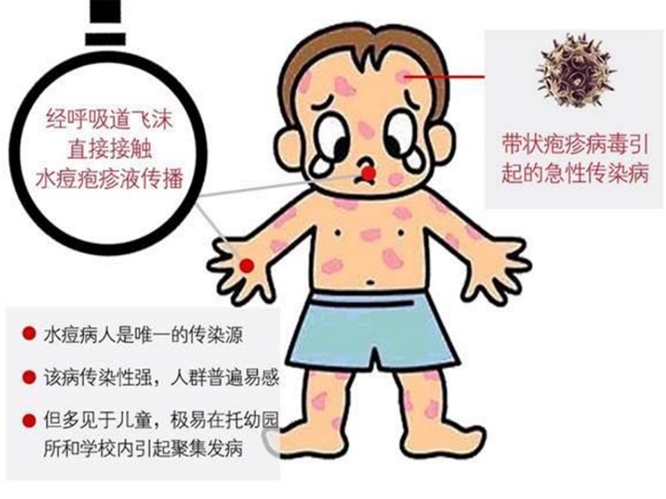 赶走磨人的水痘