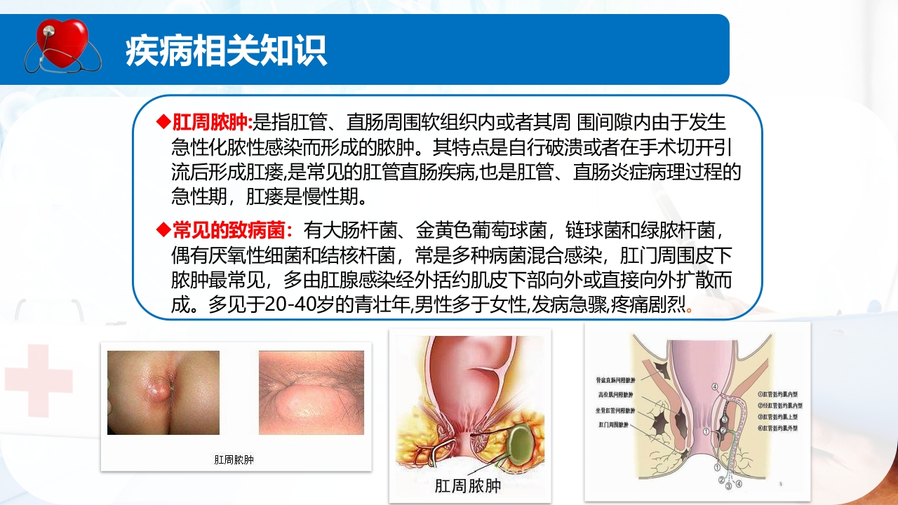 肛肠科护理查房