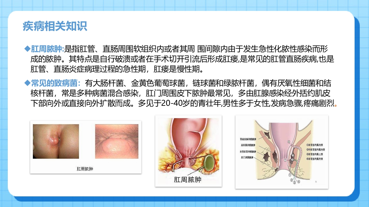肛肠科护理查房01