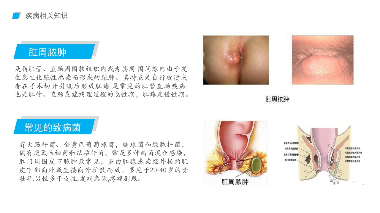 肛肠科护理查房03