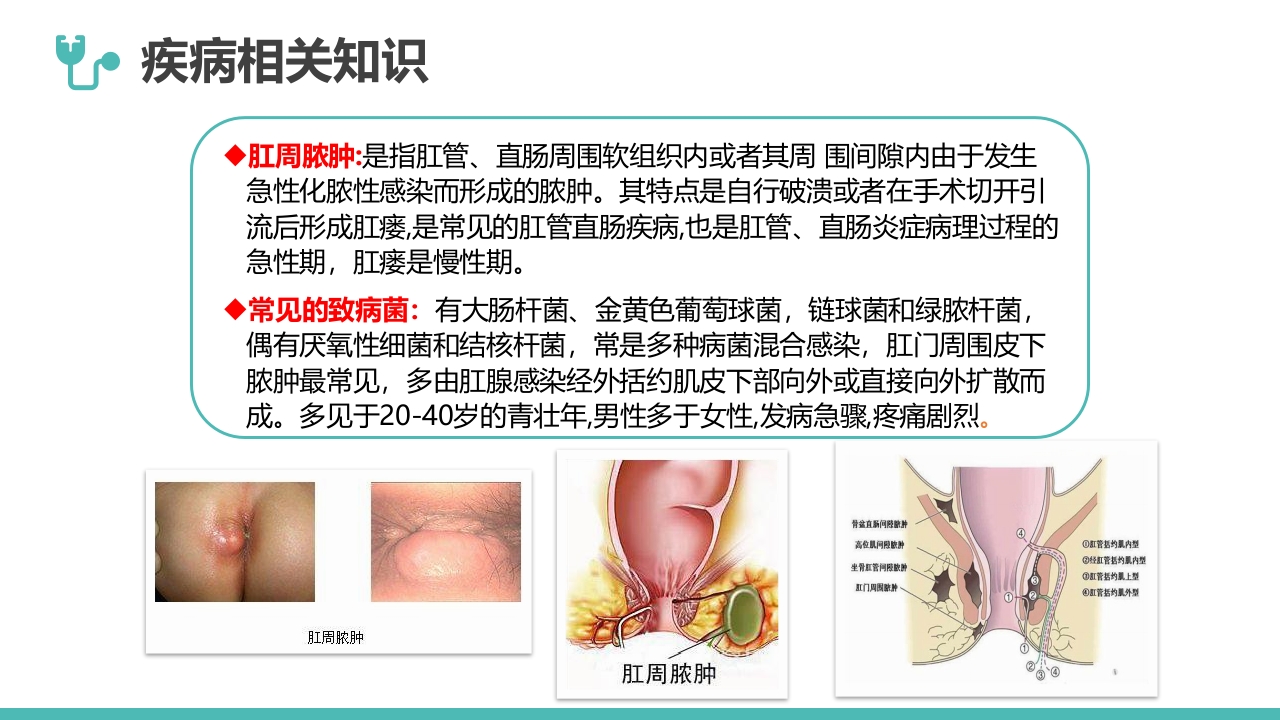肛肠科护理查房04