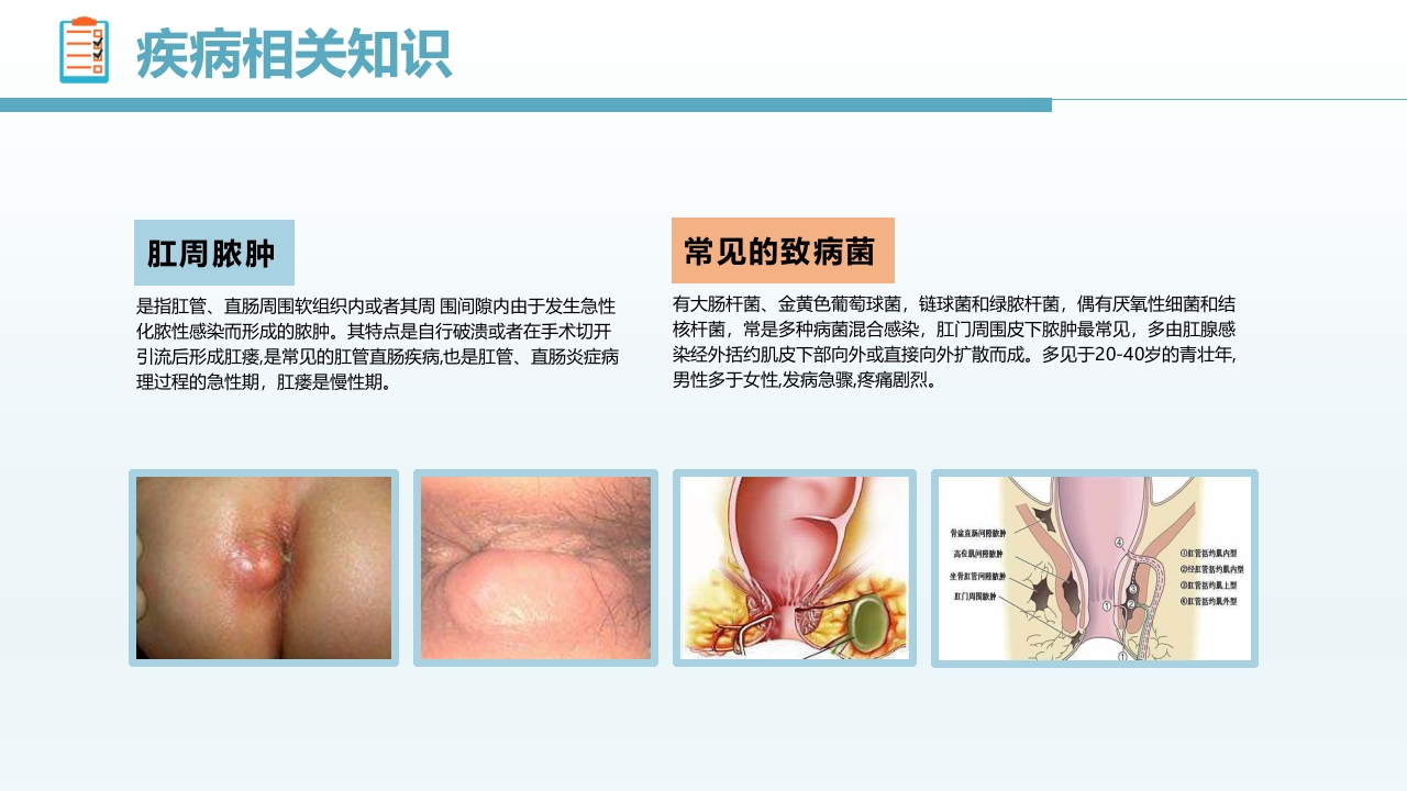 肛肠科护理查房05