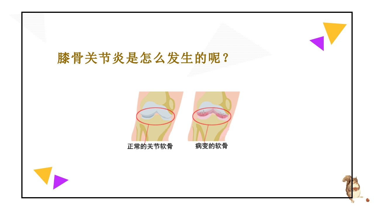 骨性关节炎患者健康宣教课件