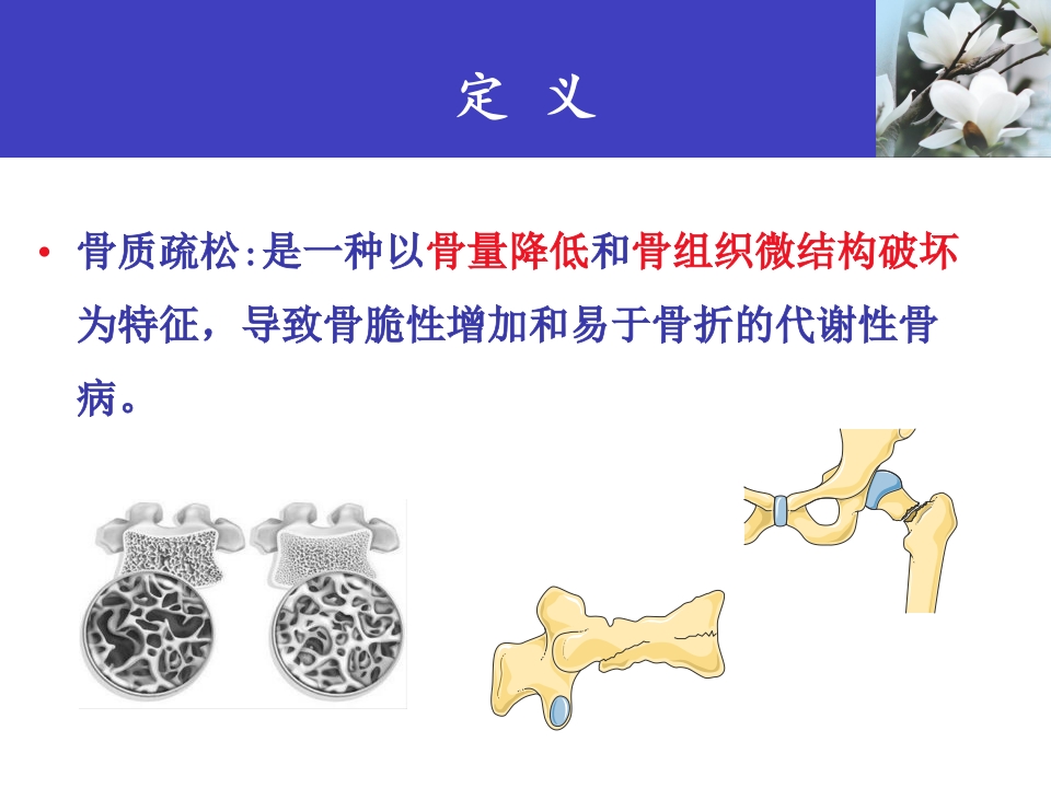 骨质疏松