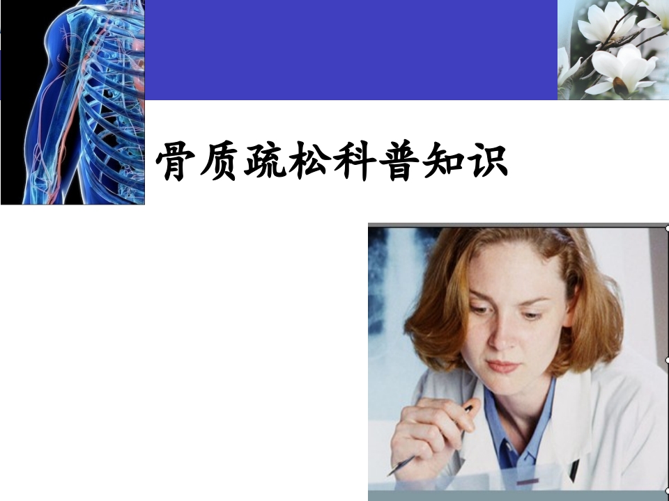 骨质疏松科普知识