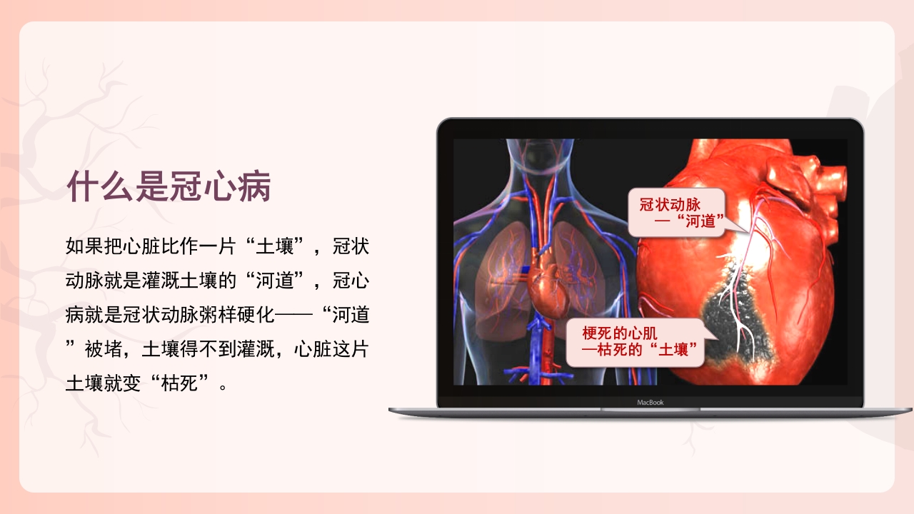 冠心病健康教育