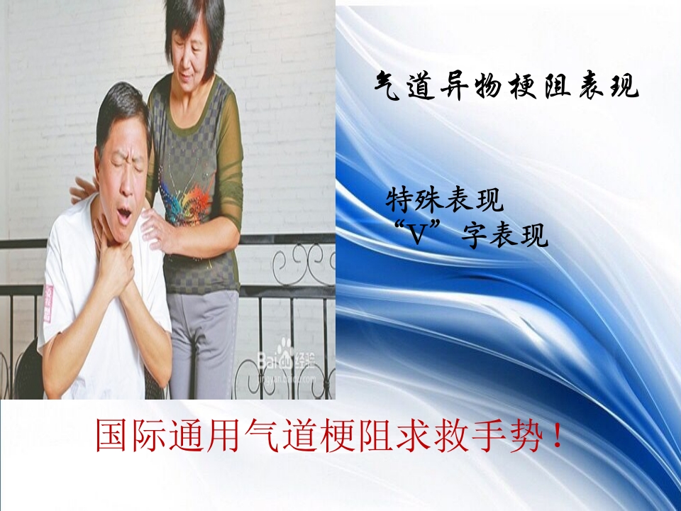 海姆立克急救法