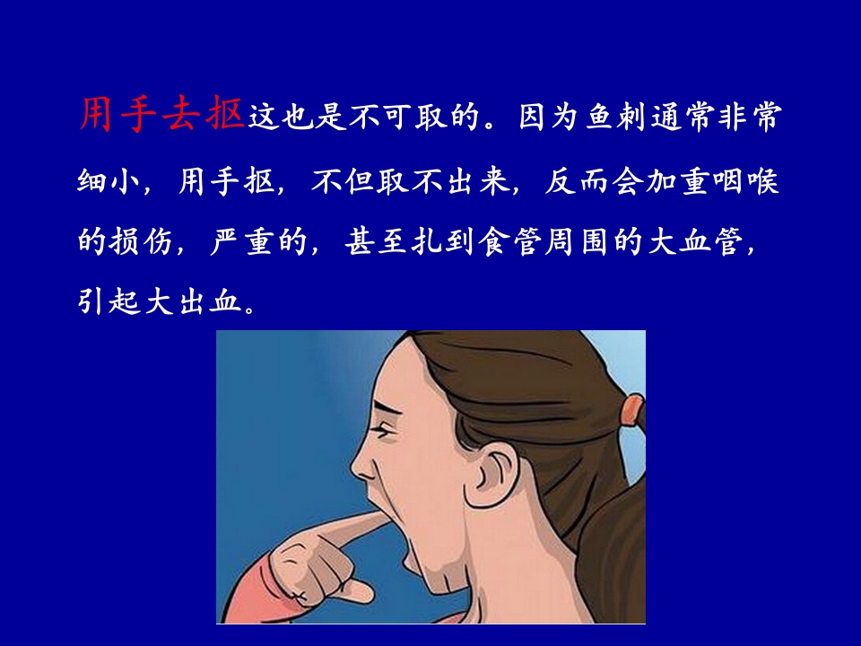 卡鱼刺了怎么办