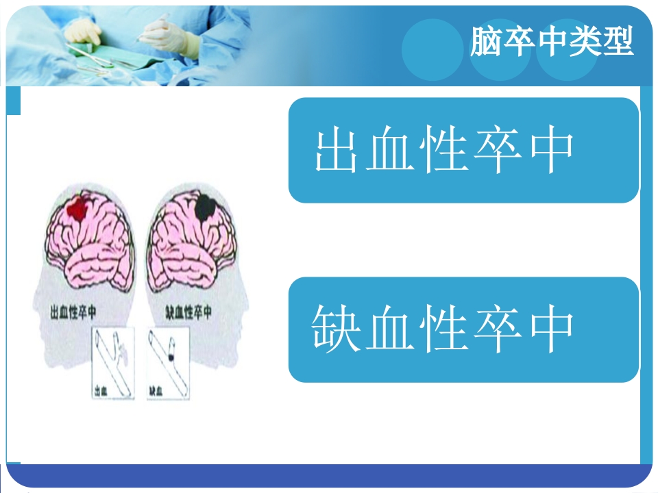 脑血管疾病的预防