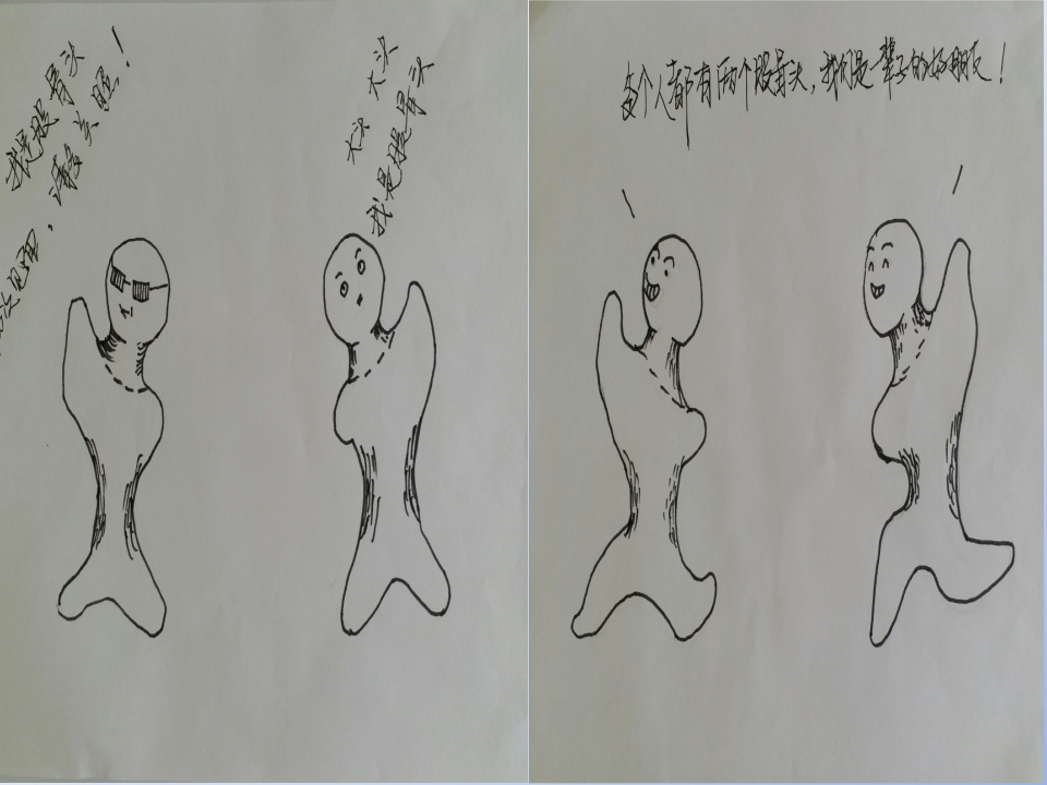 浅谈股骨头坏死