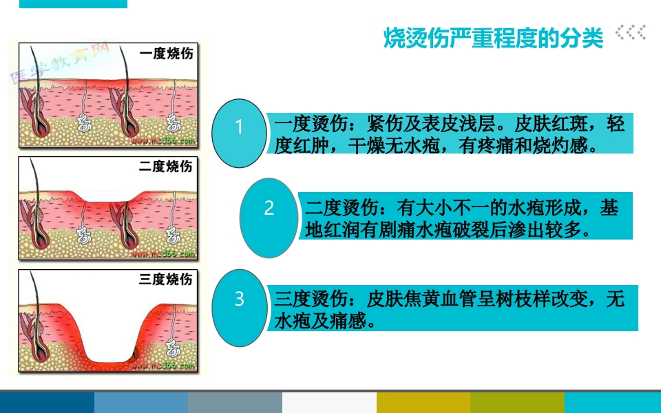 烧烫伤后的紧急处理