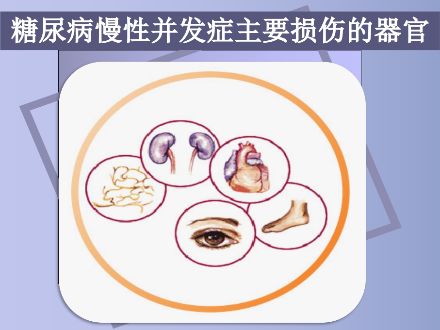 糖尿病慢性并发症及防治