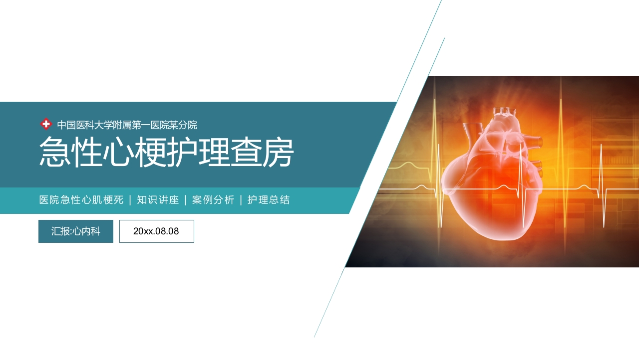 心梗心脏病护理查房病例讨论PPT