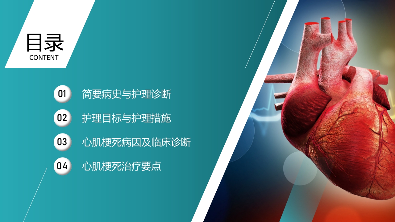 心梗心脏病护理查房病例讨论PPT