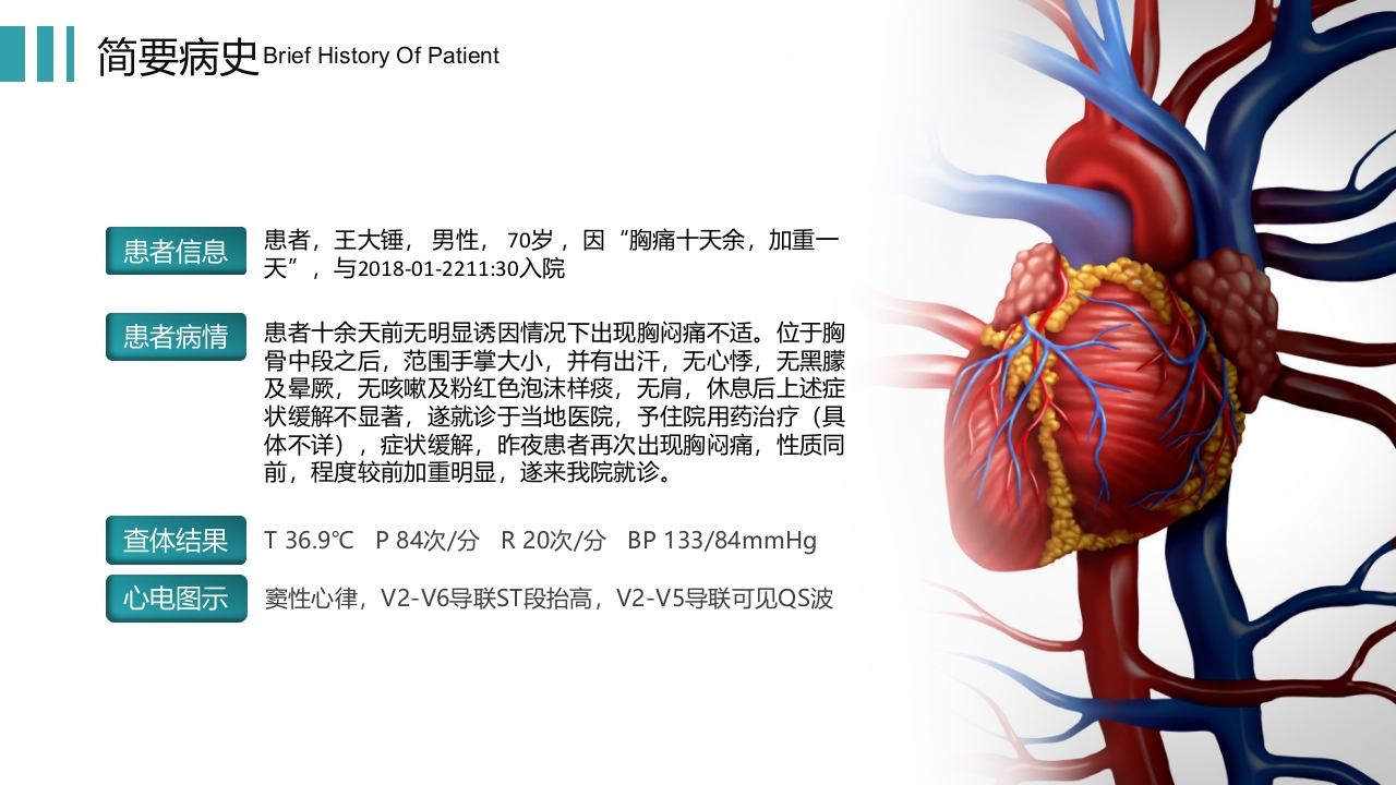 心梗心脏病护理查房病例讨论PPT