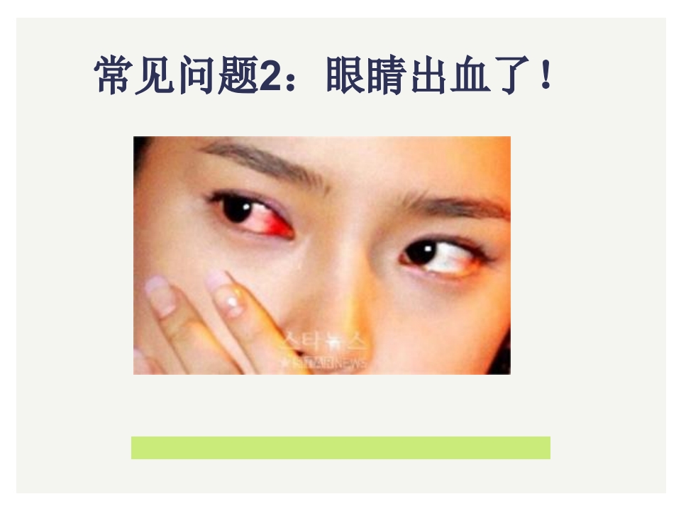 眼科小常识