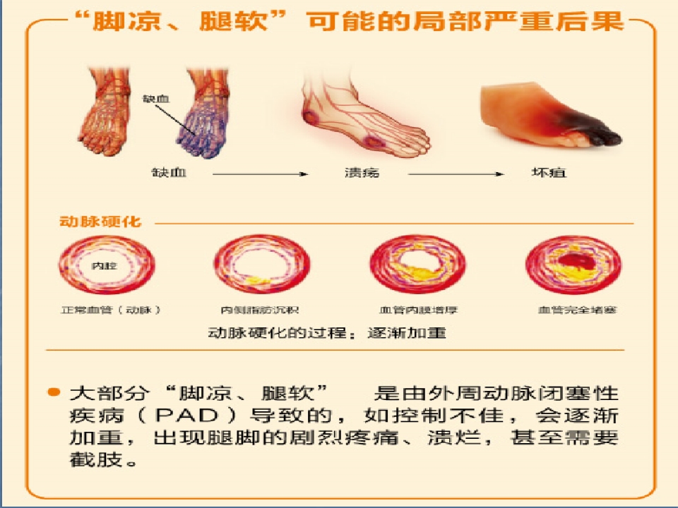 重视“脚凉”“腿软”
