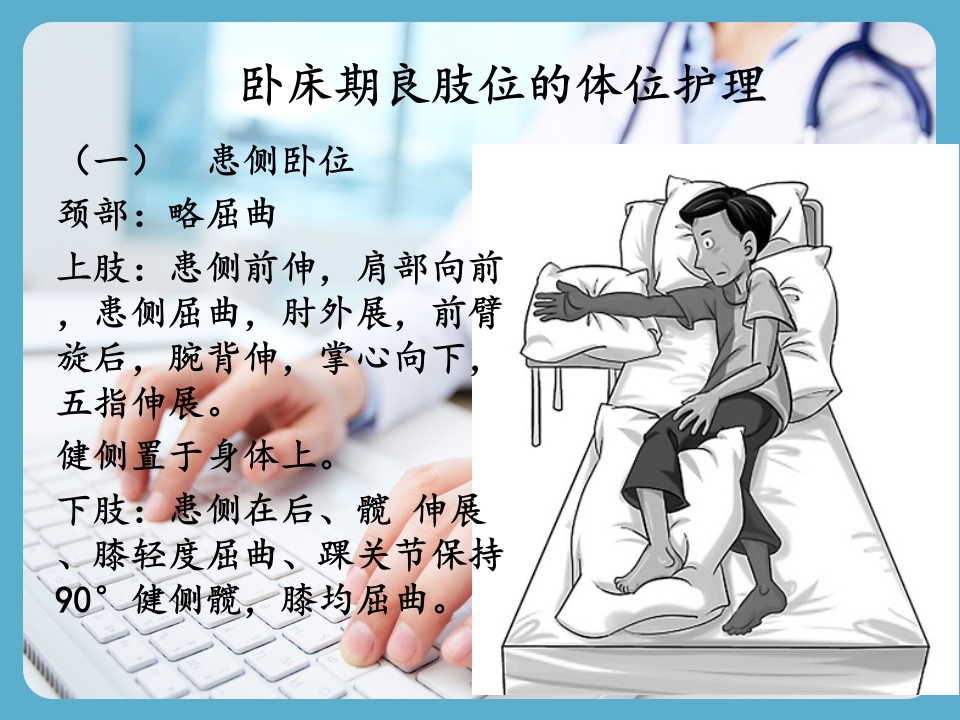 卒中本人的康复指导