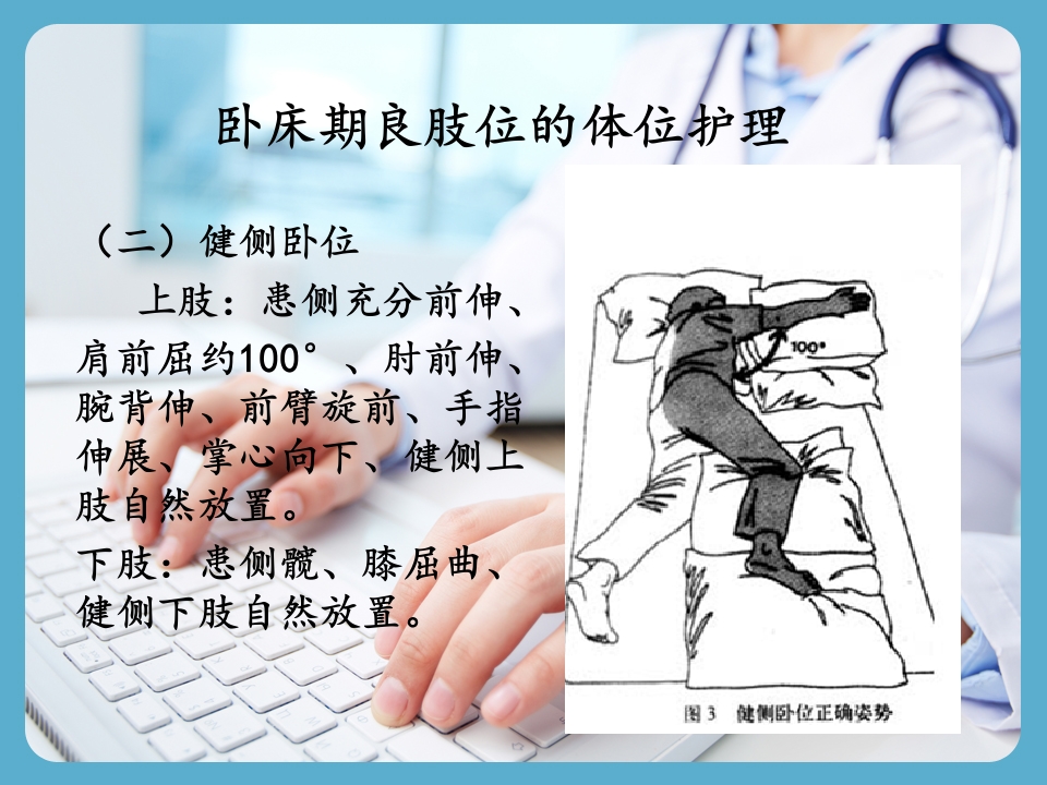 卒中本人的康复指导