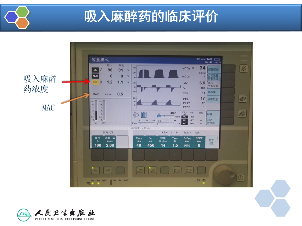 第6章 吸入全身麻醉