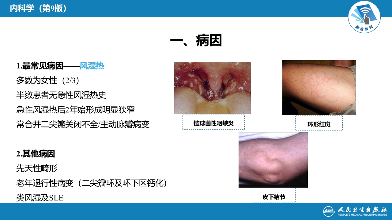 第八章 心脏瓣膜病