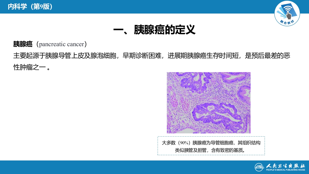 第二十一章 胰腺癌
