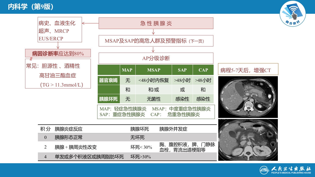 第二十章 胰腺炎