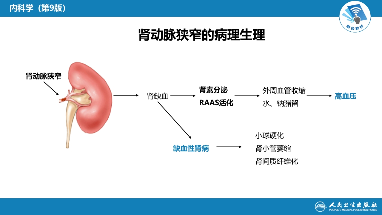 第七章 肾血管疾病