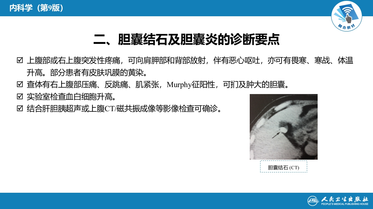 第十八章 肝外胆系结石及炎症