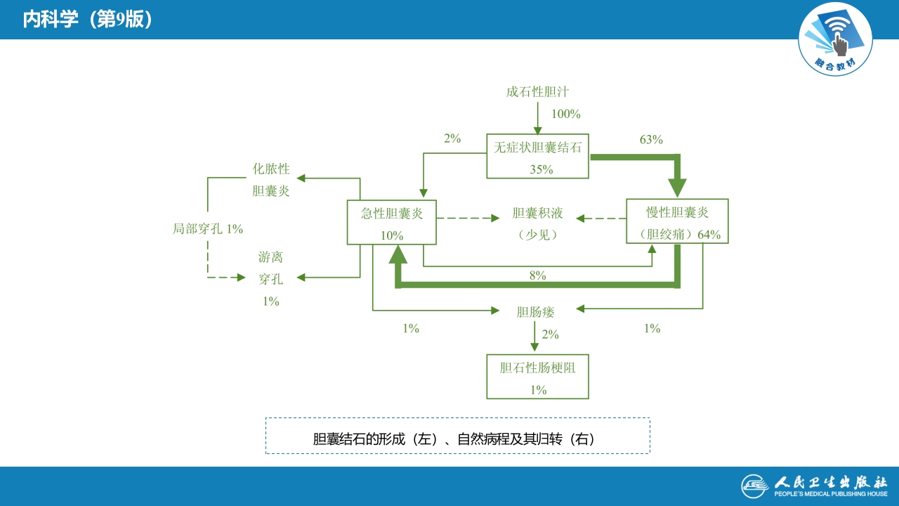 第十八章 肝外胆系结石及炎症