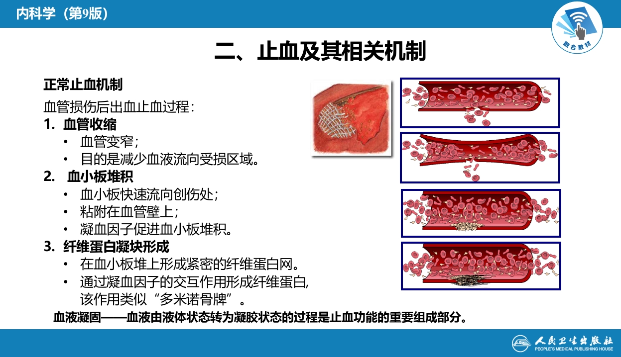 第十四章 出血性疾病概述
