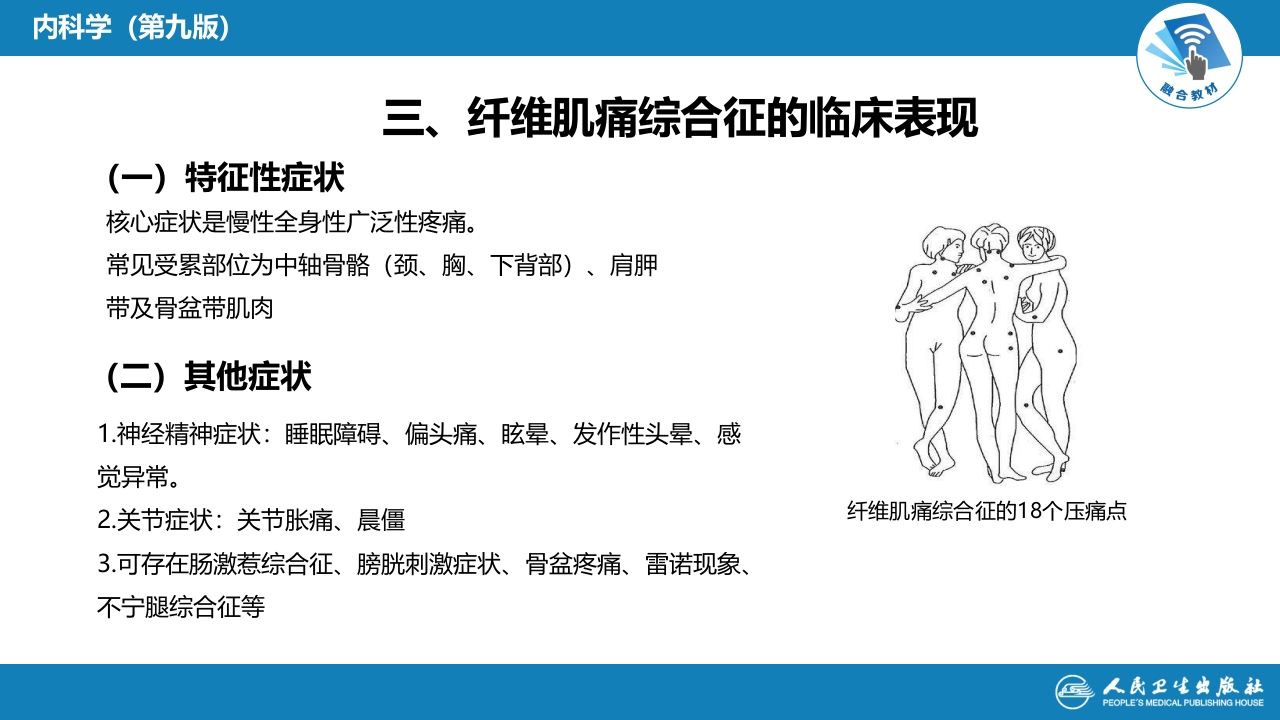 第十五章 纤维肌痛综合征