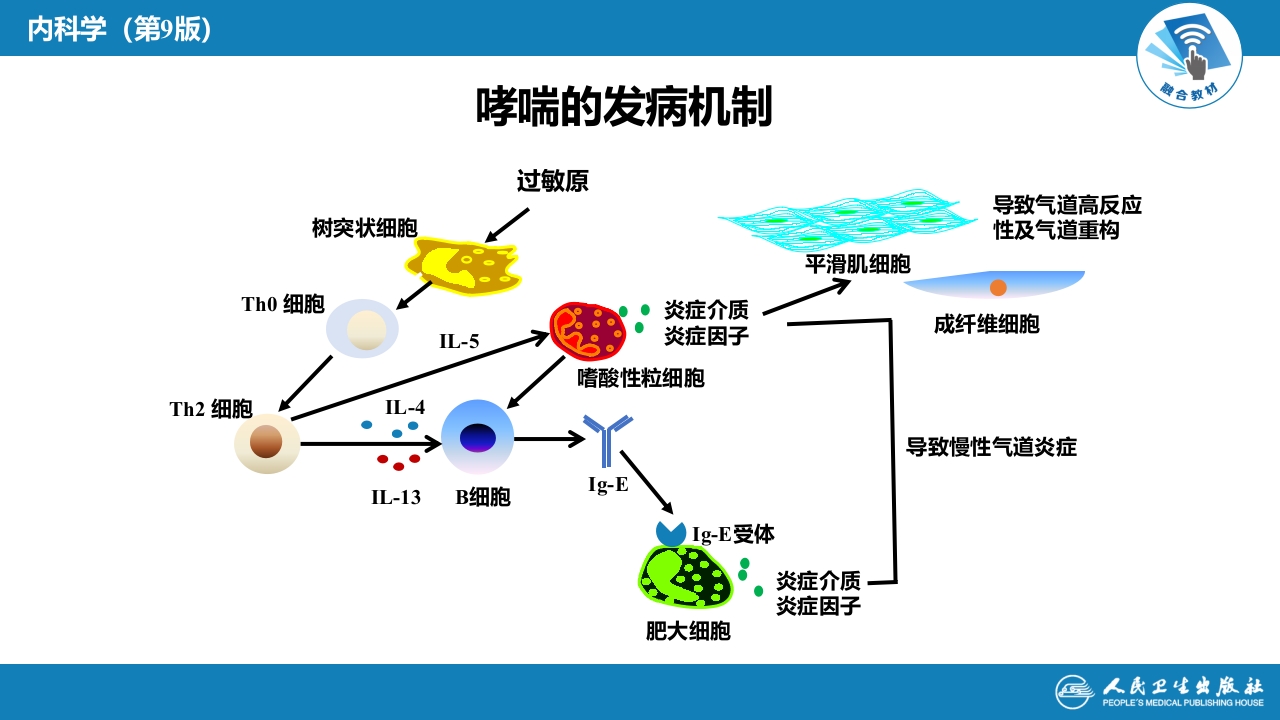 第四章 支气管哮喘