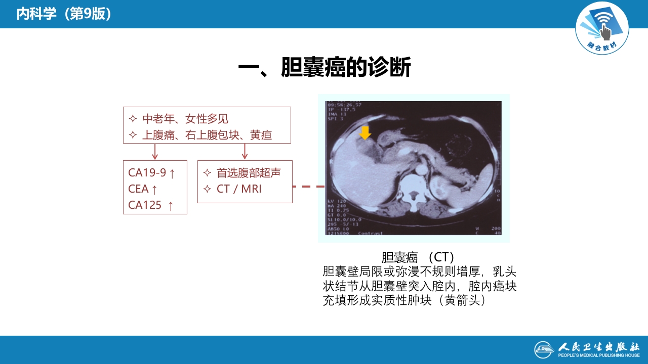 第十九章 胆道系统肿瘤