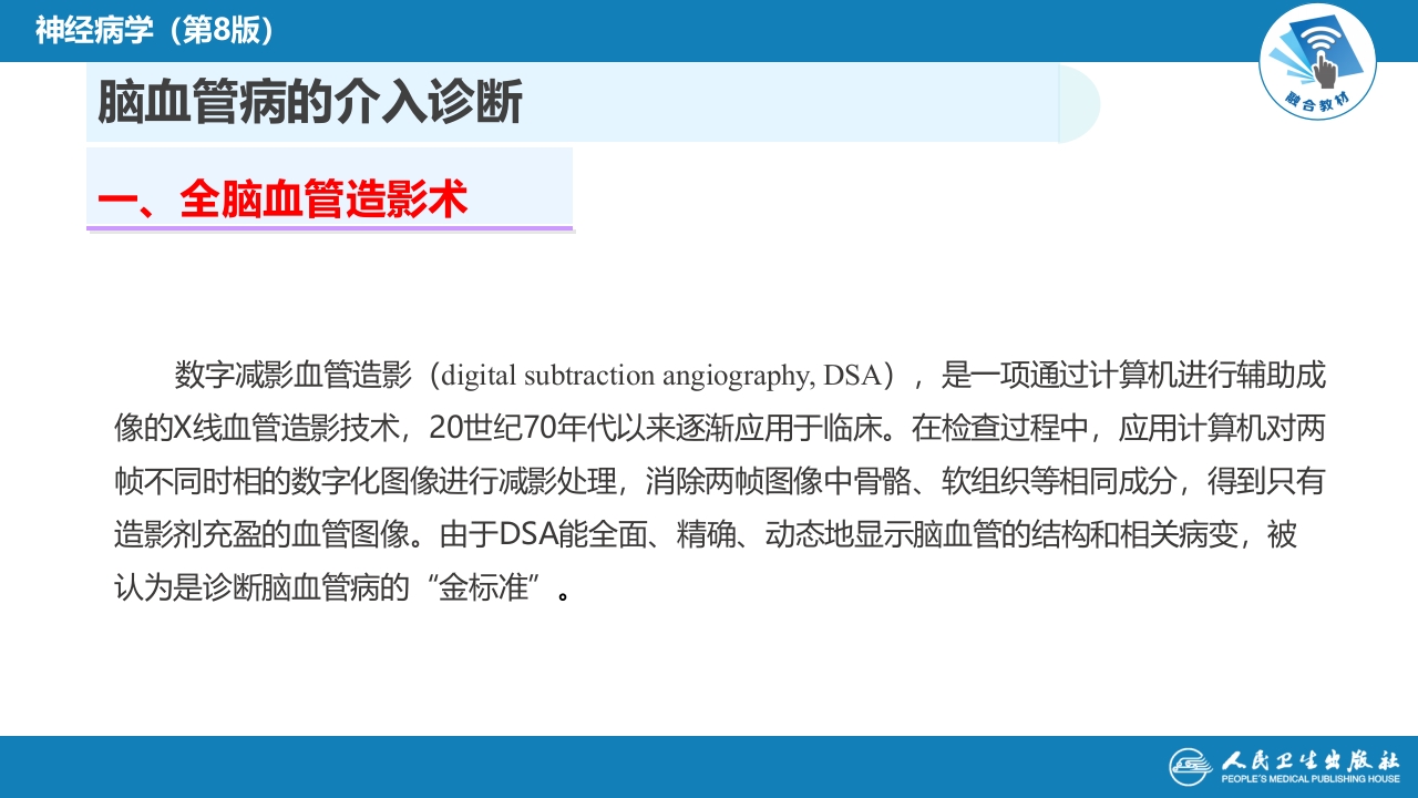 第十章 脑血管病的介入诊疗（1）