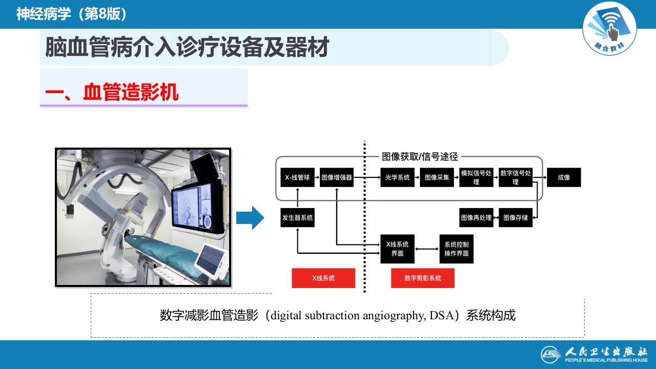 第十章 脑血管病的介入诊疗（2）
