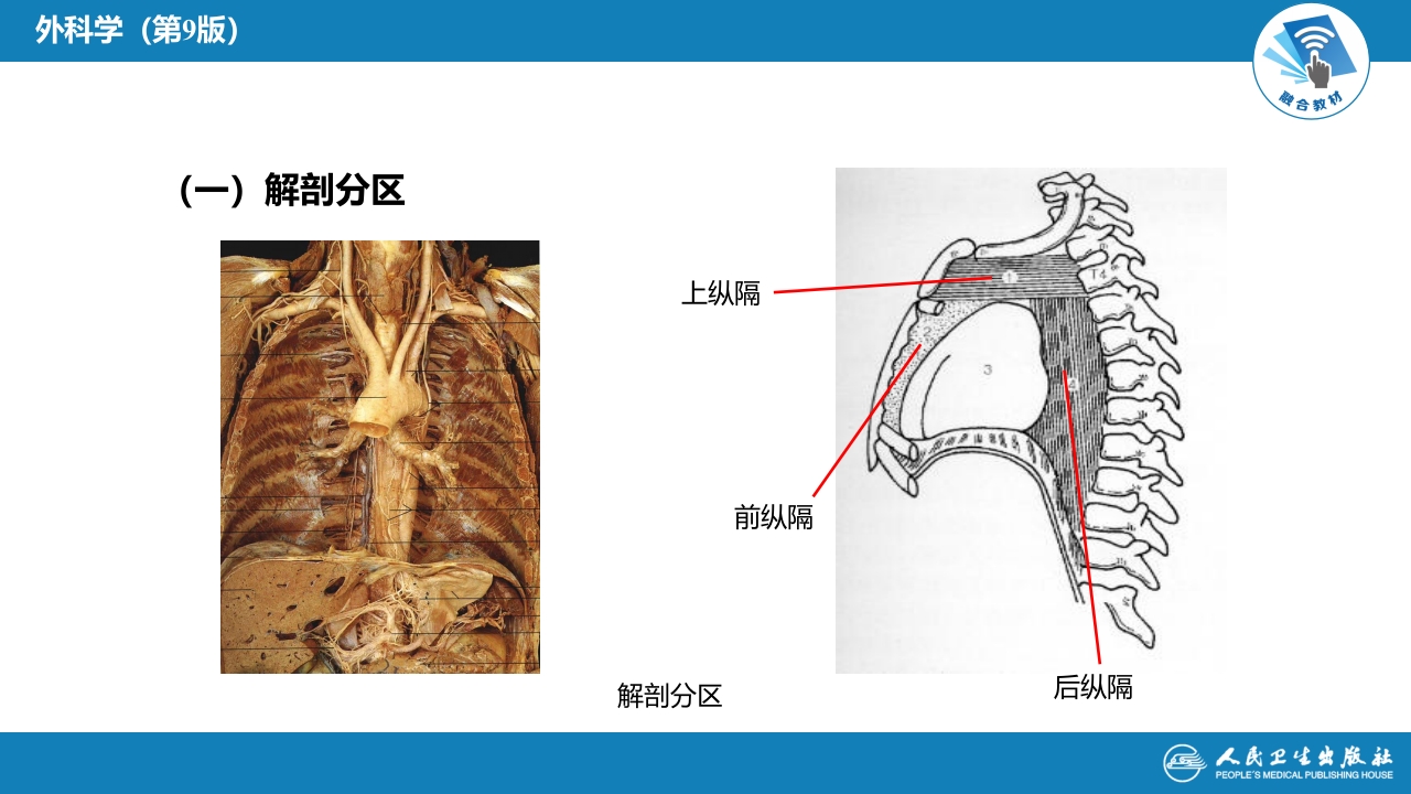 第二十八章 原发性纵隔肿瘤