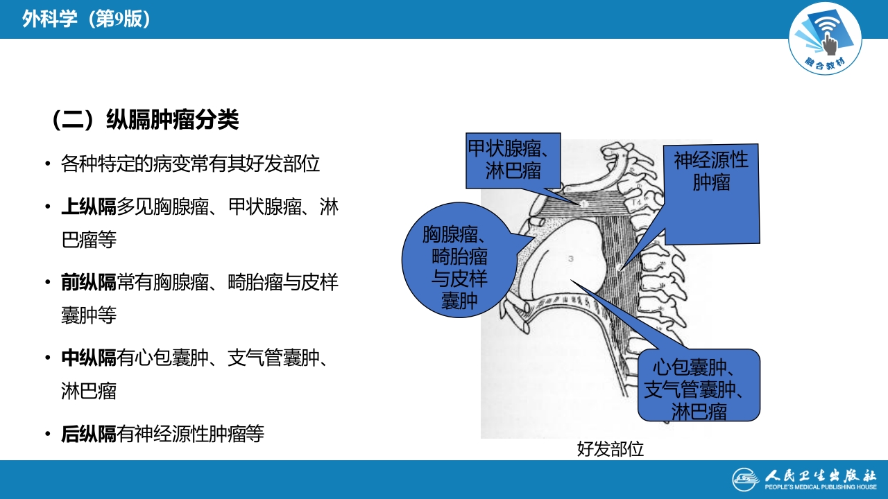 第二十八章 原发性纵隔肿瘤