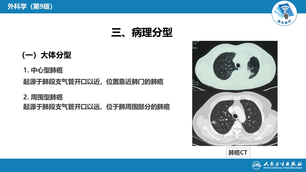 第二十六章 肺疾病