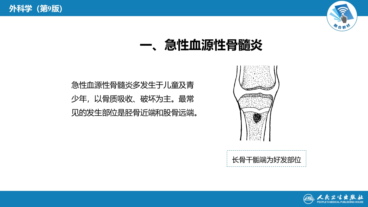 第六十八章 骨与关节化脓性感染
