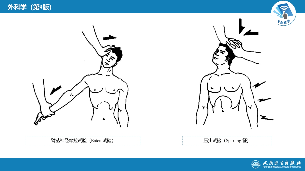 第六十七章 颈、腰椎退行性疾病 第一节 颈椎退行性疾病