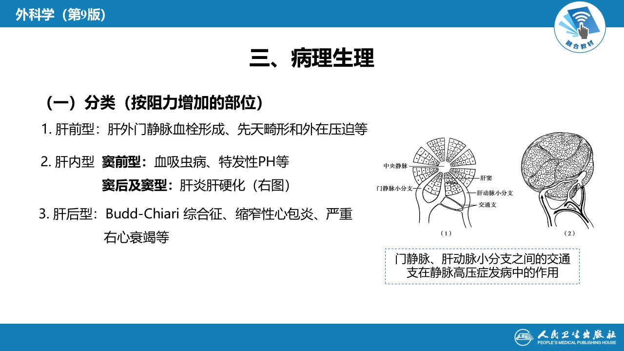第三十九章 门静脉高压症