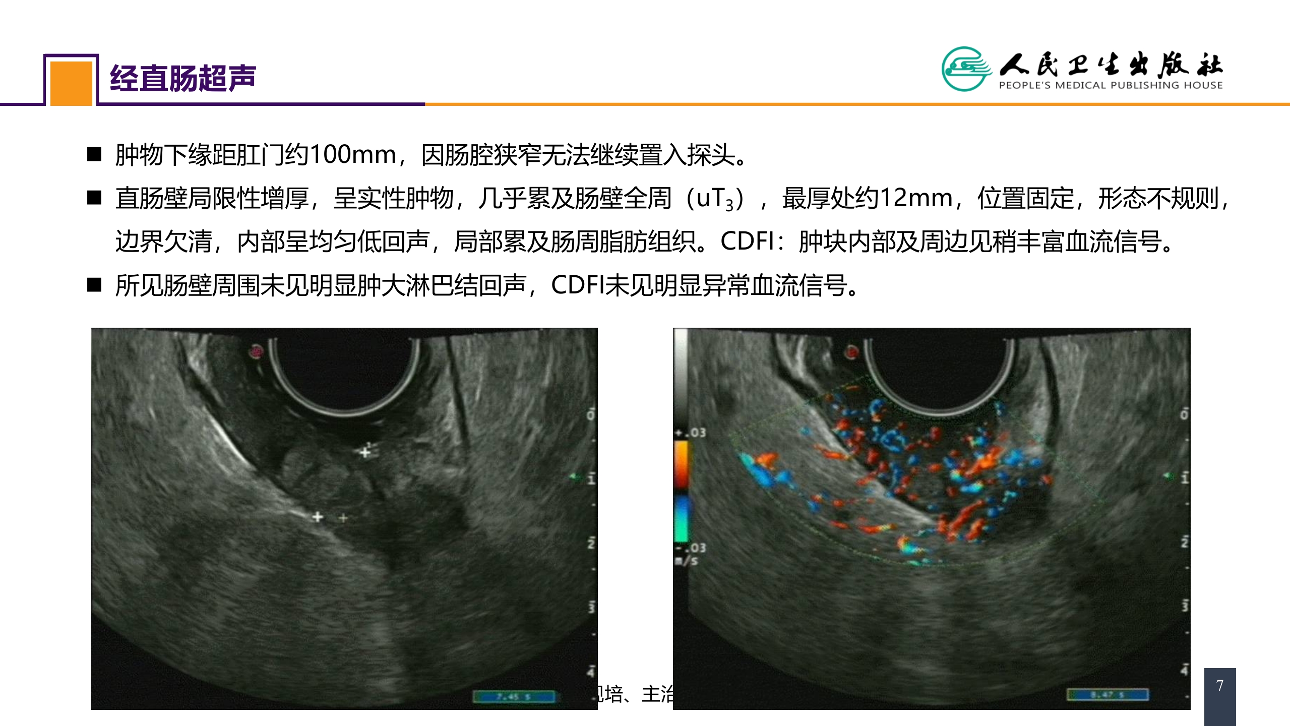 第三十七章 结、直肠与肛管疾病 案例分析-直肠癌