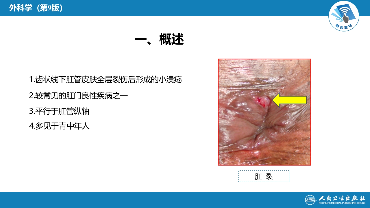 第三十七章 结、直肠与肛管疾病 第九、十、十一节 (1)