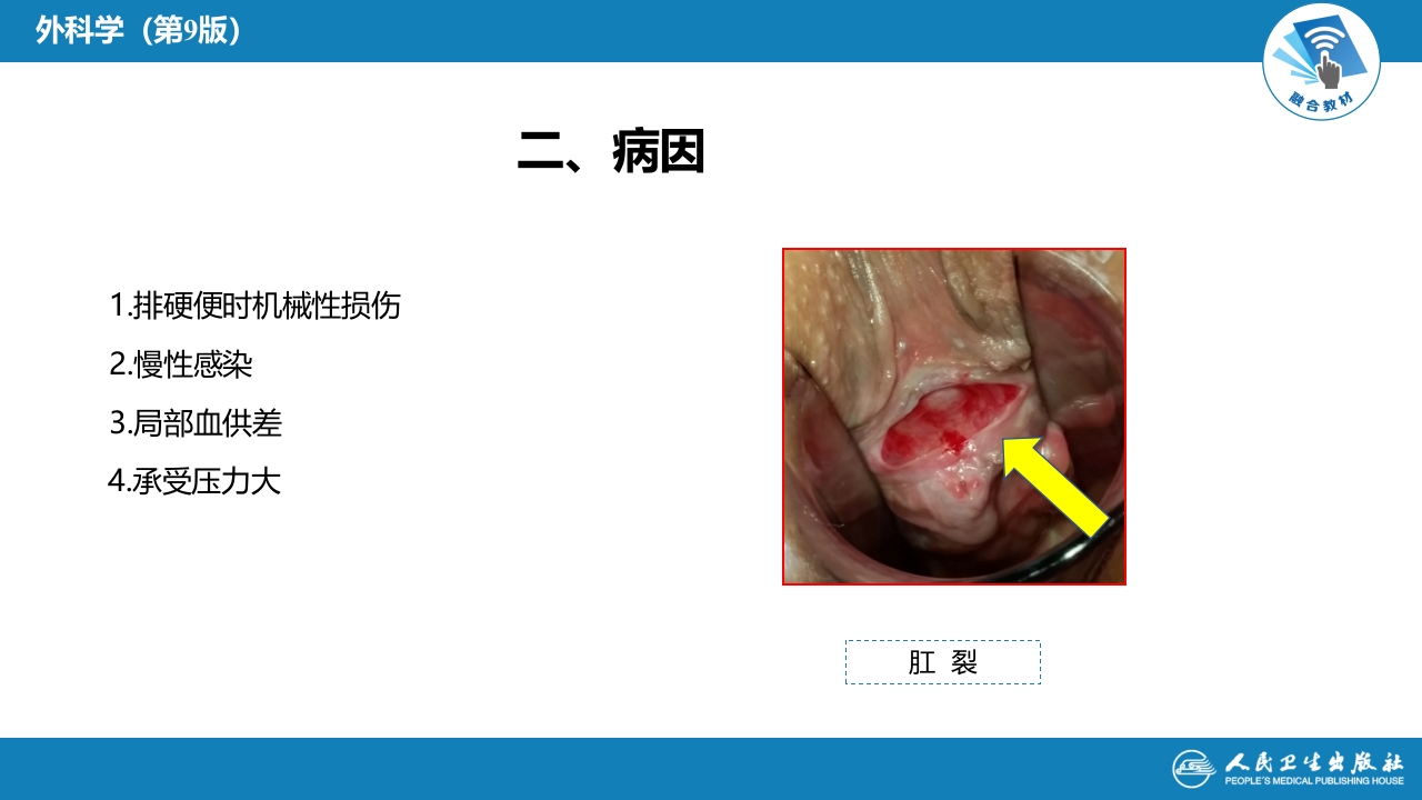 第三十七章 结、直肠与肛管疾病 第九、十、十一节 (1)
