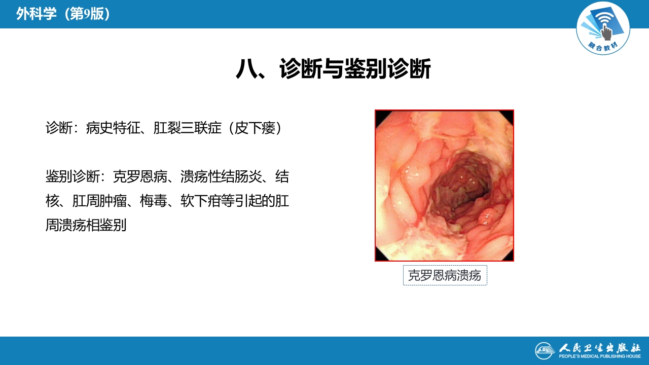 第三十七章 结、直肠与肛管疾病 第九、十、十一节 (1)