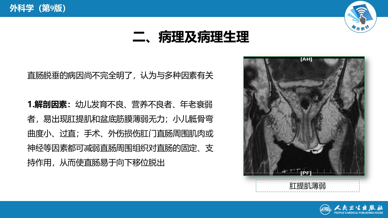 第三十七章 结、直肠与肛管疾病 第十三节 直肠脱垂