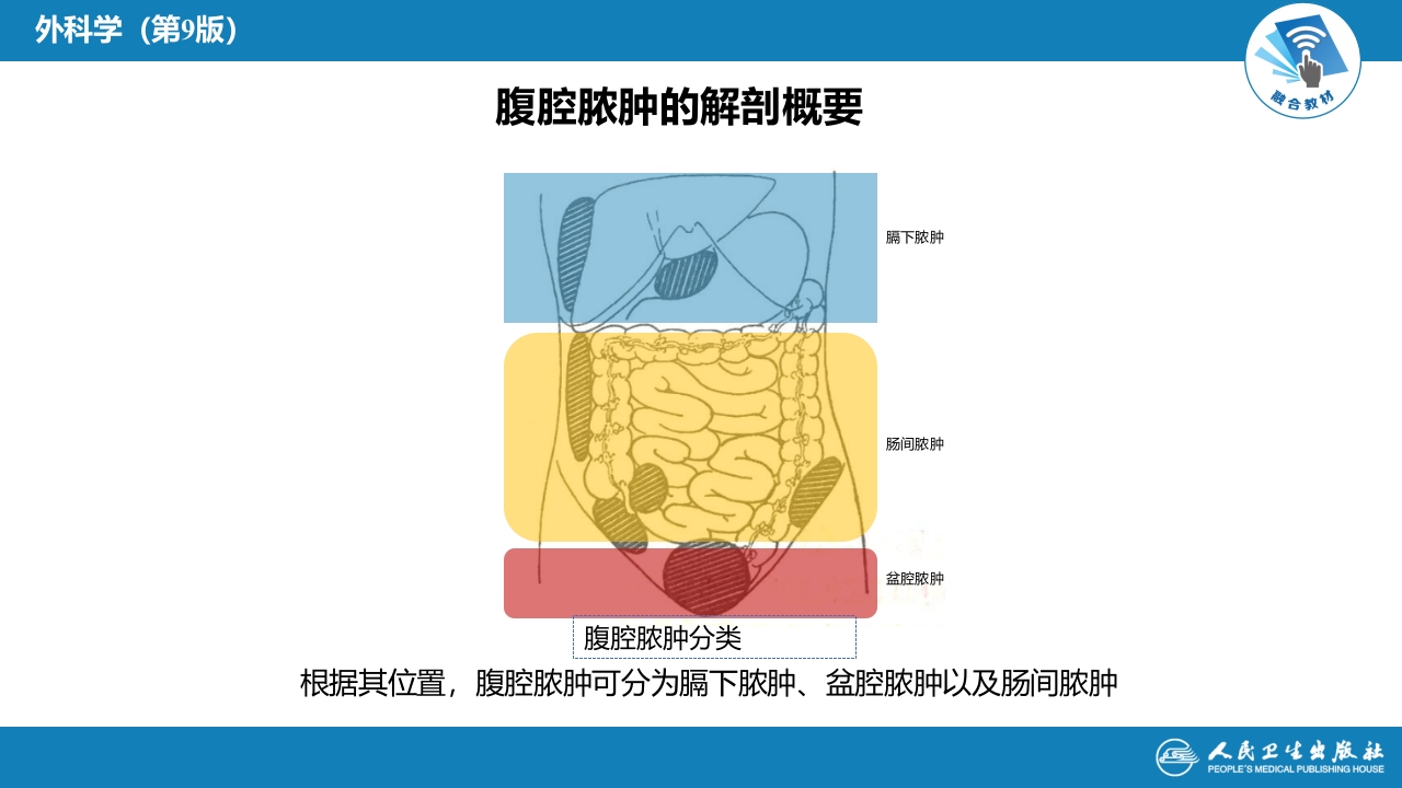 第三十三章 急性化脓性腹膜炎 第二节 腹腔脓肿