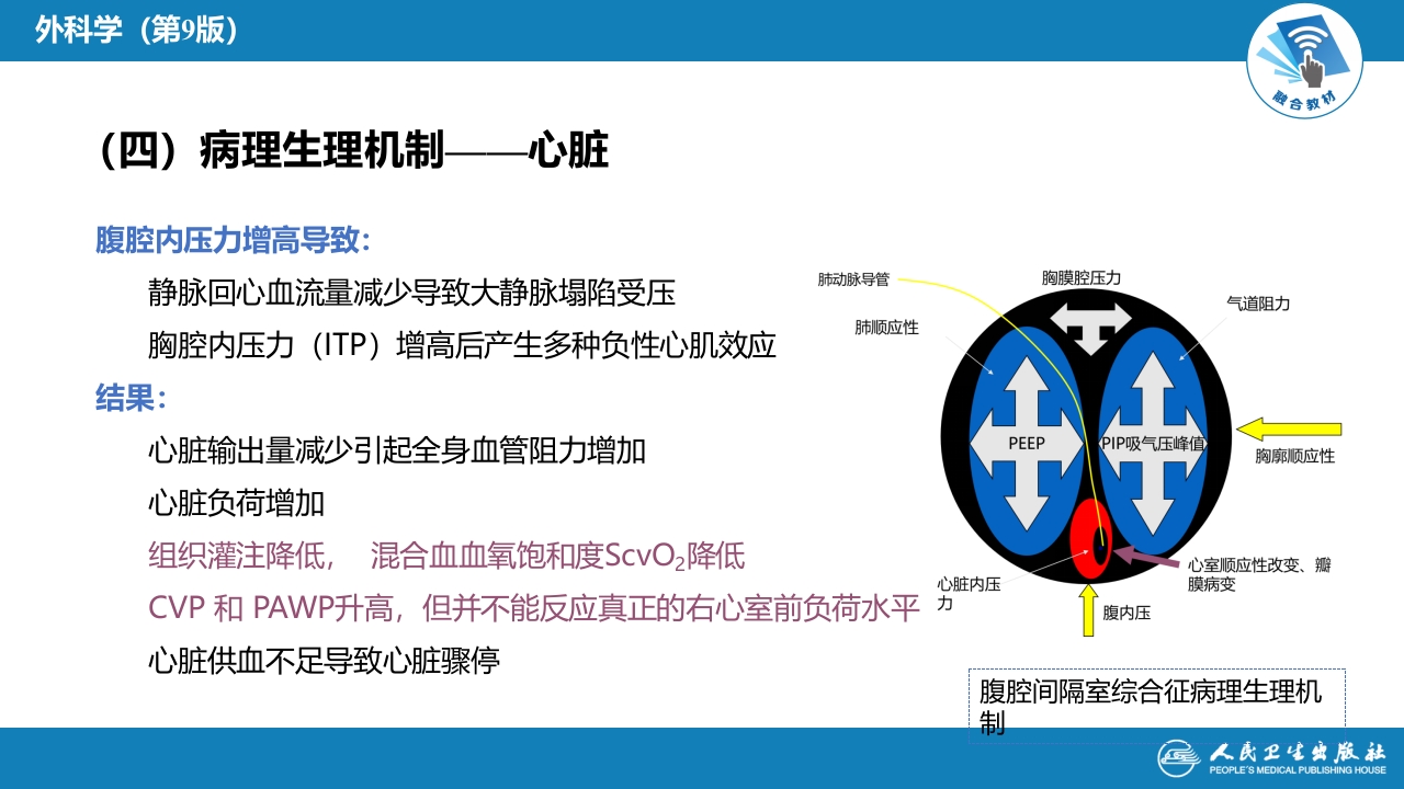 第三十三章 急性化脓性腹膜炎 第三节 腹腔间隔室综合征